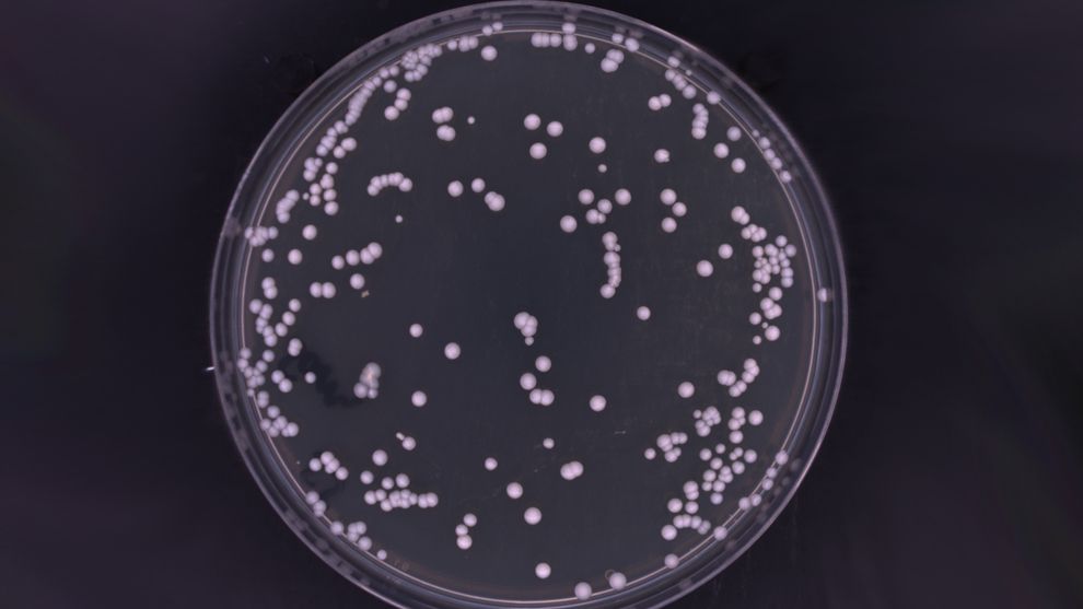 Feature image - Could this bacteria be the root cause of dandruff?