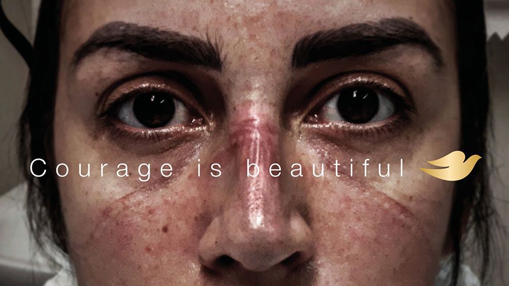 An image of a medical professional whose face has been marked by wearing a face mask